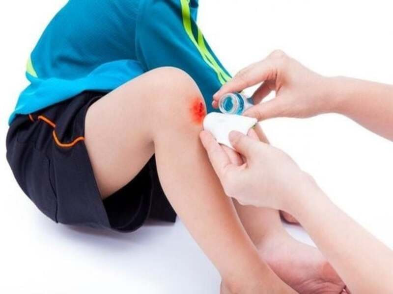 Băng keo cá nhân là gì? Cấu tạo chi tiết cần biết 15 Mẹo nhỏ: Cách tháo băng keo không đau và xử lý vị trí khó