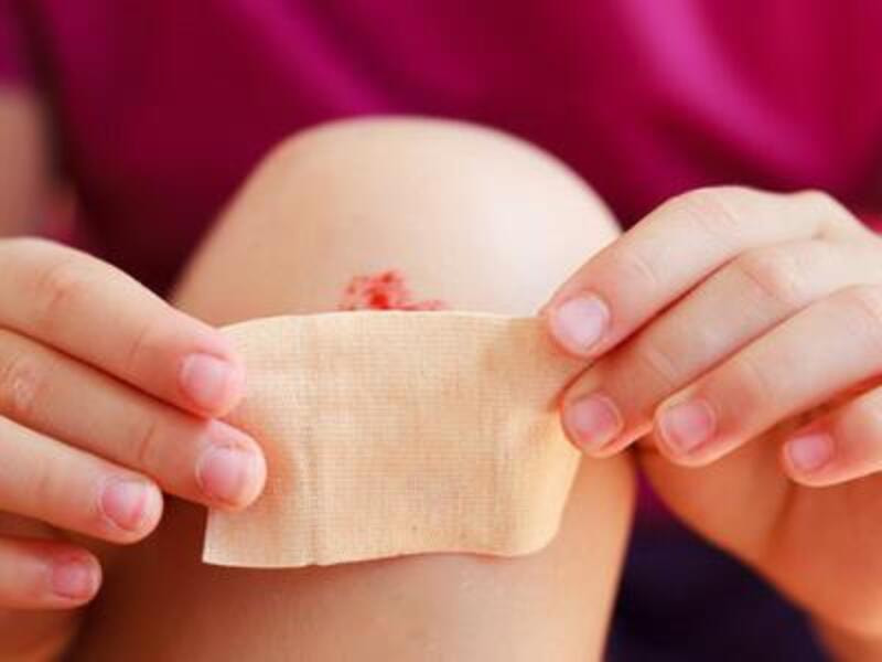 Băng keo cá nhân là gì? Cấu tạo chi tiết cần biết 14 Hướng dẫn quy trình sử dụng băng dán cá nhân đúng chuẩn y khoa